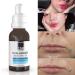 ican london Pure Hyaluronic Acid + B5 serum for face Dark sport correction Anti-aging fine line & wrinkles With vitamin C & E 30ml - Buy Online on GoSupps.com