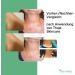 Buy Skin Fluid & Wart Remover Tincture | Effective Anti-Wart Treatment | Gentle Formula for Fibromas & Warts | International Shipping Available - Buy Online on GoSupps.com