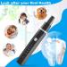 Wizcom Teeth Cleaning Kit - 5 Modes, Waterproof, Tartar & Coffee Stain Remover (Black) - Buy Online on GoSupps.com