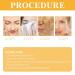 2024 Rejuvenating Honey Peel-Off Mask | Anti-Aging Nourishing & Muscle Tearing Solution - Buy Online on GoSupps.com