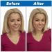 Instant Perfect Smile Kit | SHOP-STORY Replacement Tooth - Reusable & Removable | International Shipping Available - Buy Online on GoSupps.com