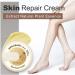 Suho Skin Healing Ointment for Cracked Heels & Dry Feet | Best Anti-Crack Hand & Foot Cream | Repair Calluses & Dead Skin - International Shipping - Buy Online on GoSupps.com