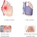 Kenanlan Bunion Corrector for Women - 2PC Toe Splints & Separators for Overlapping Big Toe - Universal Size - Buy Online on GoSupps.com