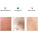 Skin Repair Cotton Pads - 60 Pieces | 0.5% Blackhead & Acne Removal | Gentle Facial Cleaning Towels - Buy Online on GoSupps.com