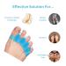 Toe Separators for Bunion Pain Relief | Foot Stretcher & Muscle Strengthening | NAOS Therapeutics | Unisex Foot Health Solution - Buy Online on GoSupps.com