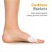 NatraCure Gel Big Toe Bunion Guards & Toe Spreaders - Pain Relief for Crooked Toes, Pressure, Hallux Bunions - 6 Count - Buy Online on GoSupps.com