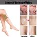 Varicose Veins Relief Patches - Soothe Leg Discomfort & Boost Circulation - 48 PCS | International Shipping Available - Buy Online on GoSupps.com