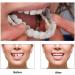 2 Pairs Adjustable Confident Smile Dental Aligners for Men & Women - White | Best International Shipping - Buy Online on GoSupps.com