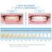 Professional Whitening Tooth Kit | Remove Coffee & Tea Stains | Tooth Polishing Powder & Liquid | Yellow Teeth Remover - Buy Online on GoSupps.com