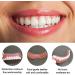 Brigtviee 2 Pairs Teeth Veneers Fake Teeth Perfect Smile Cosmetic Veneers False Teeth Temporary Whitening Treatment Click On Veneers Teeth For Men Women Regain Confident Smile - Buy Online on GoSupps.com