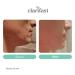 Buy Clarifast 1-Step Acne Treatment | Fast Easy & Effective with Amezol Alpha-GEE Willow Bark Extract | 2.75 fl oz - International Shipping Available - Buy Online on GoSupps.com