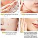 (Must - Have) Super Luxe Skin Re_mover Super Luxe Skin Re_moval Skin Tag Re_mover Cream Painless Mole and Skin Re_mover for All Skin Types (2PC) - Buy Online on GoSupps.com
