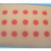Injection Training Pad | Skin-Like Intradermal Practice Skin Model for Nurse & Medical Students - Buy Online on GoSupps.com