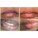 N.A.S.E 2PC Lip care Of Lips Pink Fresh Lightening Bleaching Cream Treatment Remove Dark Smoke oil Green - Buy Online on GoSupps.com