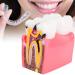 High-Quality Dental Prosthesis Model for Oral Care | International Shipping Available - Buy Online on GoSupps.com