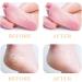 P4L 6 Pack Replacement Heads for Flawless Pedi Electric Foot File - 3 Coarse & 3 Fine Rollers - Grey - Compatible with Finishing Touch Flawless Pedi - As Seen on TV - Buy Online on GoSupps.com