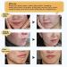 Scar & Acne Marks Removal Ointment Gel (2 Pack) - Skin Repair for Scars Burns Cuts Stretch Marks & Acne Spots - Effective Redness Cream for Face & Body - Buy Online on GoSupps.com