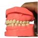 Ernzi Removable Dentures Model - Ideal Typodont for Dental Practice & Study Lessons - Buy Online on GoSupps.com