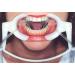 2PCS Dental Retractor Set - Saliva Intraoral Lip & Wange Retractors for Dentistry | Small Size for Dry Oral Areas - Buy Online on GoSupps.com