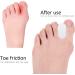 Gel Toe Separators - Correct Overlapping Toes - Hallux Valgus Foot Care Tools - Buy Online on GoSupps.com