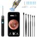 AROSKY Ear Wax Removal 1920P Clearest Ear Camera with Light Visible Ear Cleaner Ear Wax Removal Kit Ear Wax Cleaner Remover Ear Wax Cleaning Kit Earwax Removal Kit Tool with Soft Silicone Tips
