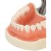 Upper Jaw Cyst Dental Model - Soft Gum 28 Teeth Practice Frame for Abscessing (International Shipping) - Buy Online on GoSupps.com