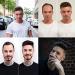 Real Hair Toupet for Men | Yanahair Smooth Thin French Tip Wigs | Light Brown European Hair System (10x8) - Buy Online on GoSupps.com