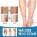 GeRRiT Organic Varicose Vein Treatment Cream Varicose Vein Treatment Varicose Vein Treatment on Legs Reduces Spider Veins and Heaviness - Buy Online on GoSupps.com