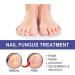 ZERZK 10ml Repair Nail Fungus Treatments Essence Foot Care Nails AntiInfection Toe Fungus Serum Onychomycosis Removal Gel - Buy Online on GoSupps.com