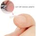 (12 +3) Ingrown Toenail Correction Treatment Kit Ingrown Toenail Correction Strips Brace Kit Ingrown Toenail File and Lifter Ingrown Toenail Corrector Straightener Strips for Nail Foot Care - Buy Online on GoSupps.com
