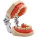 Ernzi Dental Training Model for Demonstration - Adult Teeth with Removable Screwdrivers | International Shipping Available - Buy Online on GoSupps.com
