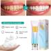 Niacinamide Whitening Toothpaste Fresh Breath Whitening Toothpaste Stain Remover Toothpaste Repairs and Protects Teeth Sensitive Teeth and Gums (1pc) - Buy Online on GoSupps.com