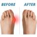 4 Pairs Body Feet Aligner Kit | Orthopedic Bale Correction Gel & Toe Rings for Foot Shape & Pain Relief - Buy Online on GoSupps.com