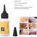 Scar Removal Cream - Acne Scar Treatment Serum for Smooth & Delicate Skin 20mL - Buy Online on GoSupps.com