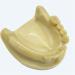Fhuili Teeth Implant Model - Realistic Dental Simulation for Practice & Education | Lower Half Teeth Demonstration Model - Buy Online on GoSupps.com