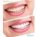 Teeth Whitening Gel - DOUCEUR Whitening Pen (2 Pcs) | Effective Painless No Sensitivity & Travel-Friendly - Buy Online on GoSupps.com