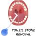 EIRZNGXQ Tonsil Stone Remover Tool - Manual Oral Cleaning for Adults & Children - Yellow | Effective Tonsil Care - Buy Online on GoSupps.com