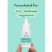 Rael Miracle Clear Acne Treatment Serum - 1.5% Salicylic Acid 2% Niacinamide Pore Minimizer Even Skin Tone | Korean Skincare (1oz 30ml) - International Shipping - Buy Online on GoSupps.com