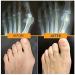 Splint for Hallux Valgus - Big Toe Straightener & Pain Relief - 1 Pair White Toe Spreaders | International Shipping - Buy Online on GoSupps.com
