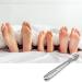 Foot Care Pedicure Shaver Stainless Steel Remover Wood Handle Heel Razor Shaver Sets Including 1 Callus Shaver 1 Foot File Heads 50 Replacement Blades Care Tools Steel Handle Hard Skin for Hand Feet solid wood - Buy Online on GoSupps.com
