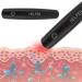 SOONHUA Itching Relief Pen - Bite & Itch Relief Treatment - Buy Online on GoSupps.com