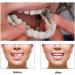Buy 2 Pairs of Men's & Women's Temporary Cosmetic Confident Smile | International Shipping Available - Buy Online on GoSupps.com