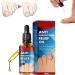 (100% Effective) KYOSK 10ml German Anti Paronychia Relief Oil Anti Paronychia Relief Oil Treatment Repair Paronychia Improve Toenail Health (1pcs)