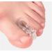 Toe Separators  2 Pair Breathable Big Toe Spacers  Soft Gel Bunion Corrector Pads  Orthopedic Big Toe Straightener Toe Treatment Tools for Hallux Valgus  Overlapping Hammer Toes  Bunions  Calluses