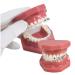 Dental Teeth Model Demonstration Orthodontic Model Teeth Teach Study Tools With Metal And Ceramic Red