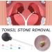 Manual Tonsil Stone Remover Tool for Adults | Mouth Cleaning Care & Ear Wax Removal | 1pcs Green - Buy Online on GoSupps.com