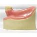 Buy Fhuili Dental Implant Practice Model - Mandibular Missing Teeth Simulation with Soft Gums for Oral Demonstration - Ideal for Dental Training - Buy Online on GoSupps.com