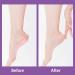 Foot File Callus Remover Double-Sided Foot File Pedicure Rasp Foot File Foot Rasp for Hand Feet Care Removing Dead Skin Tools Effective Removal Dead Skin Callus Cracked Skin(Pink) - Buy Online on GoSupps.com