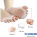 Toe Separators & Straighteners - Bunion Corrector for Hammertoe & Crooked Toes - Buy Online on GoSupps.com