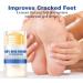 TUITUII Hydrating and Anticracking foot cream foot care for foot cream very dry feet foot care cream foot care ure cream relieves extreme dryness and cracking of the feet 40 - Buy Online on GoSupps.com